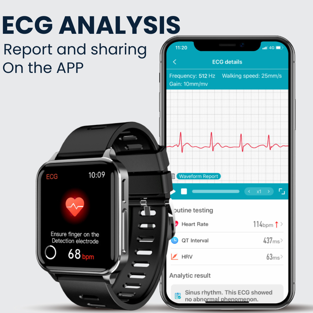 CFDA-zertifizierte Gesundheits-EKG-Smartwatch mit Blutsauerstoff-Herzfrequenzmesser, Schlafüberwachung, Gesundheits-Tracker-Uhr