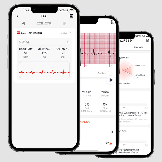 IMeasure your ECG anytime, anywhere