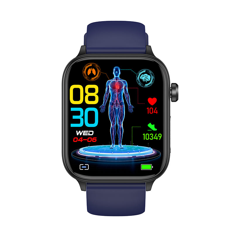 FITAOS Pro 6 EKG Blutzucker Intelligente mikrophysikalische Untersuchung Stressmonitoring Smartwatch 