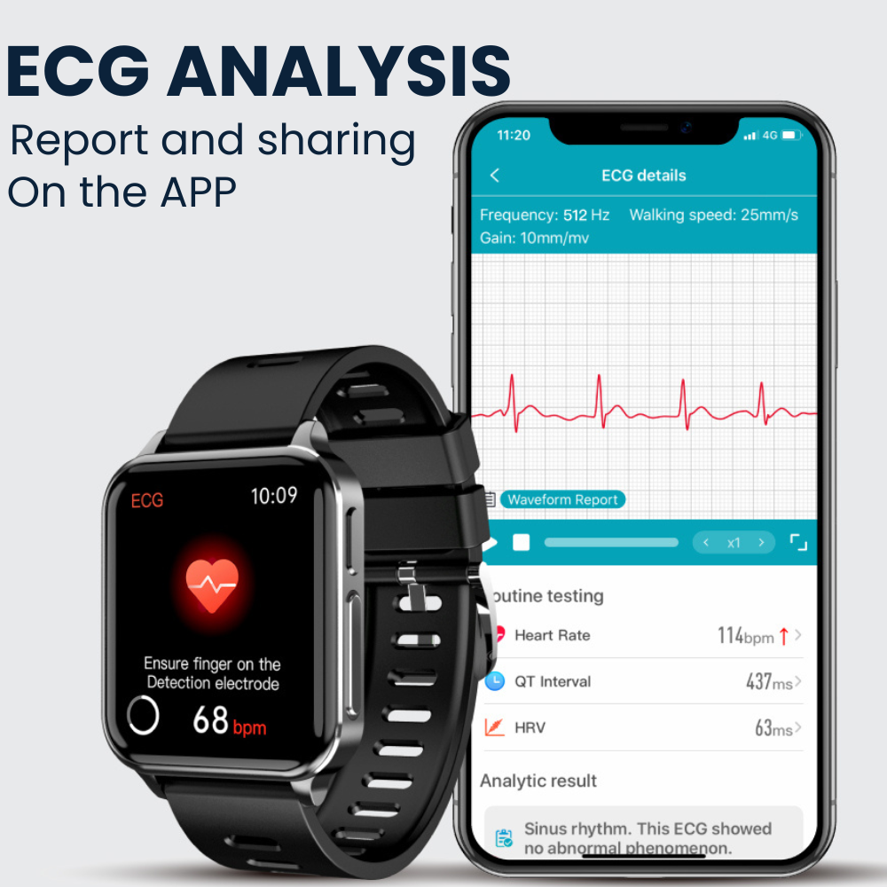 CFDA-zertifizierte Gesundheits-EKG-Smartwatch mit Blutsauerstoff-Herzfrequenzmesser, Schlafüberwachung, Gesundheits-Tracker-Uhr 