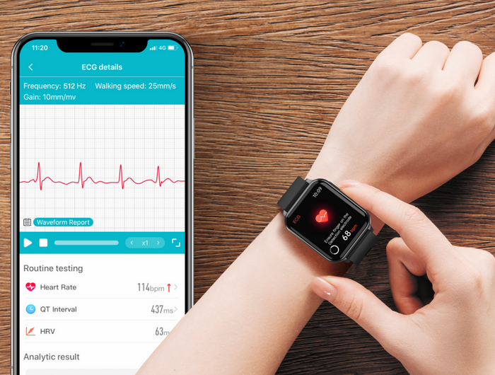 <p><strong>“I bought the watch for the ECG, which most fitness watches do not have unless you want to pay $300–$500 bucks.”</strong></p>